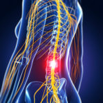 Diabetes and Chronic Back Pain